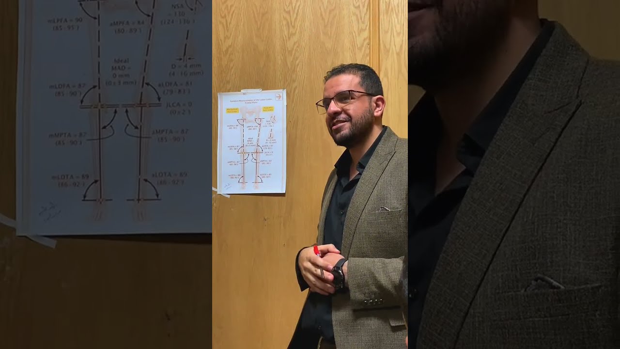 Standing Full length x.ray lower limb أشعة عادية طولية علي الطرفين السفليين 