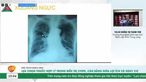 VILA - Ca bệnh lâm sàng trong điều trị COPD