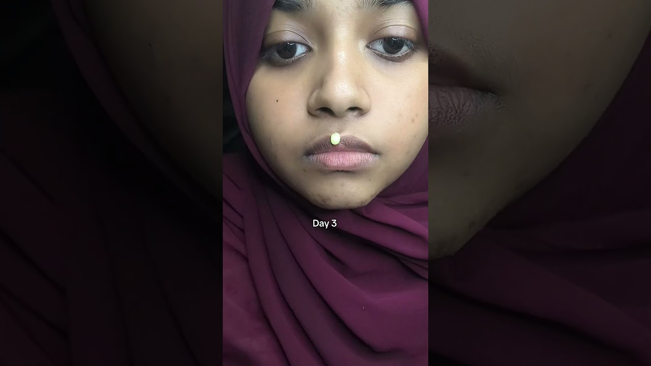 ksecret retinal serum. lip brightening with ksecret retinal serum. 