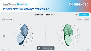 EinScan Medixa | Episode 3 – Software Update 1.1🇬🇧🇺🇸 screenshot 3