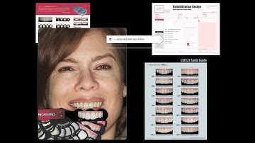 How to use Chairside Shade Guide - Method 1