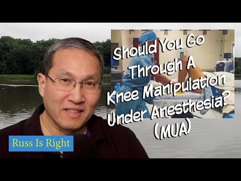 Should You Do A Knee Manipulation Under Anesthesia? -  MUA - Knee Update #21