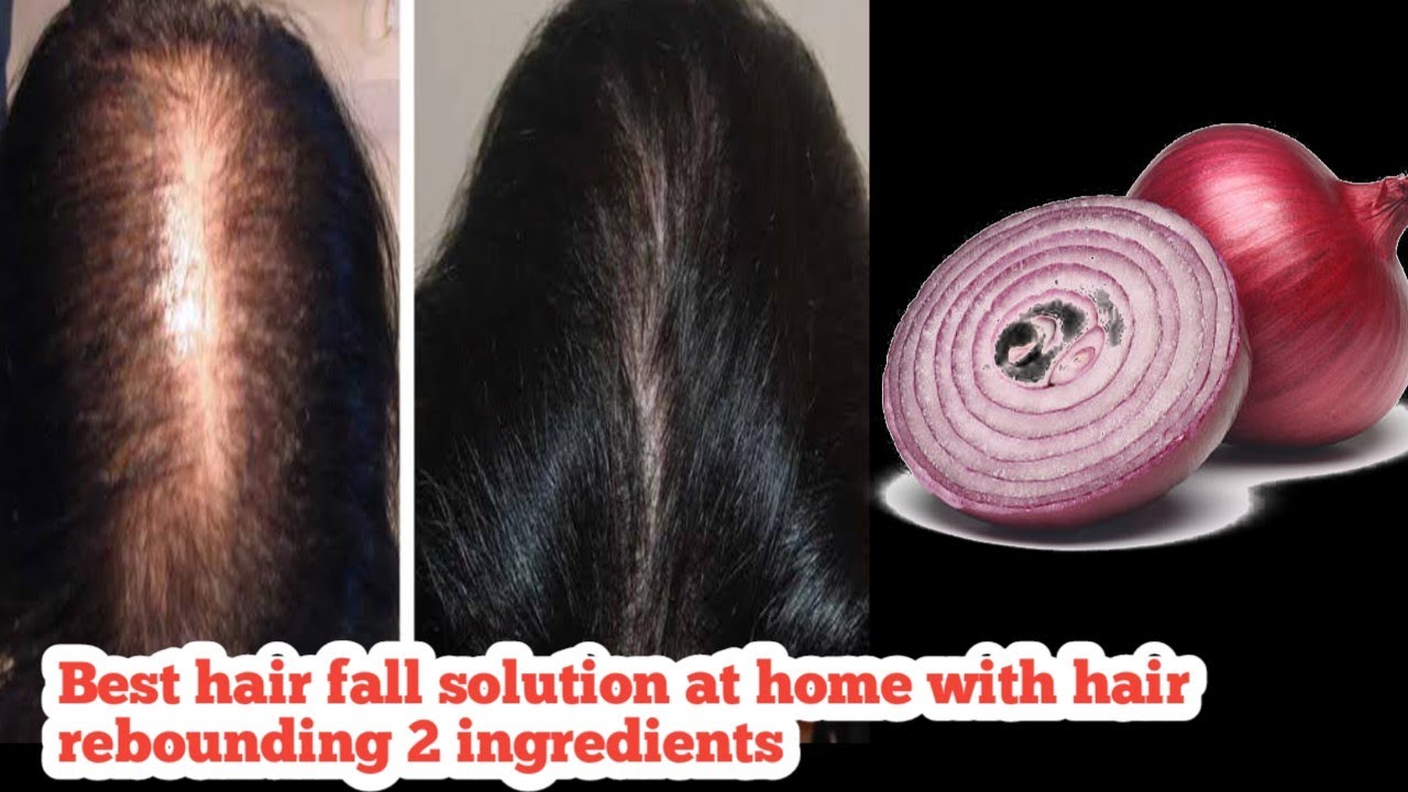 natural remedies | how to stop hair loss | hairfall and hair growth ...