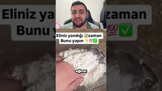 Eliniz Yandıysa Un Kullanın Vıa Mutfak Kelebegi27