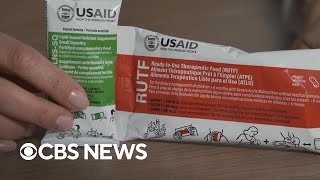 Malnutrition food product sees funding affected by USAID cuts
