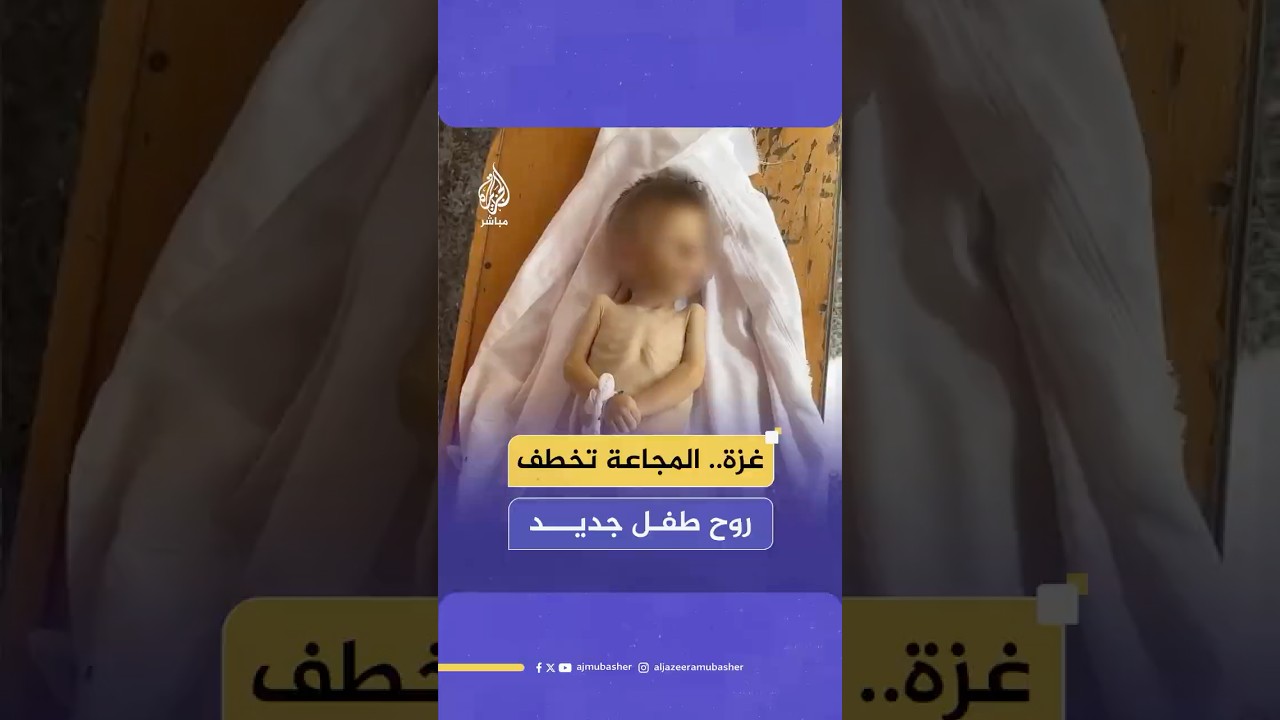 المجاعة تحصد روح طفل جديد.. استـ ـشـهـاد الطفل سيف حلس في مدينة غزة نتيجة سوء التغذية