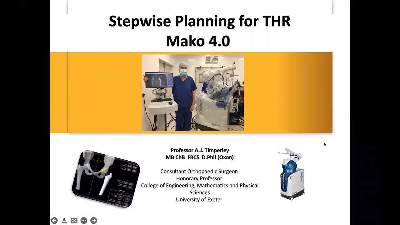 Planning robotassisted total hip replacement (MAKO 4.0). Use with tendonsparing SPAIRE