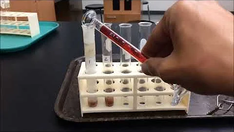 Unveiling the Mysteries of Catalase: The Liver's Role in Hydrogen Peroxide Reaction