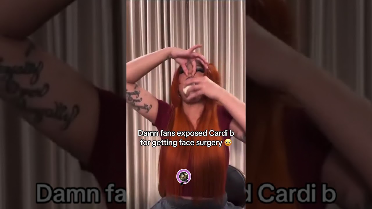 Fans EXPOSE Cardi B's Face Surgery