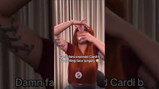 Fans EXPOSE Cardi B's Face Surgery