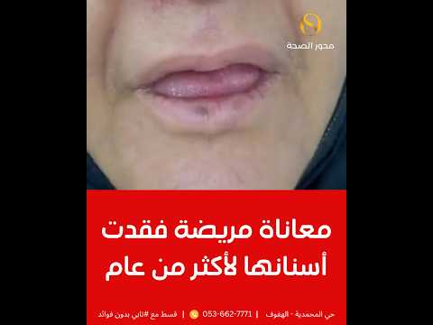 د. نادر المبارك افضل دكتور زراعة اسنان في الاحساء ٢٠٢٦