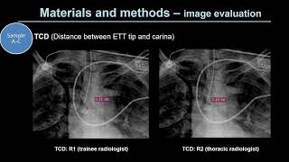 AI for Assessment of Endotracheal Tube Position on Chest Radiographs