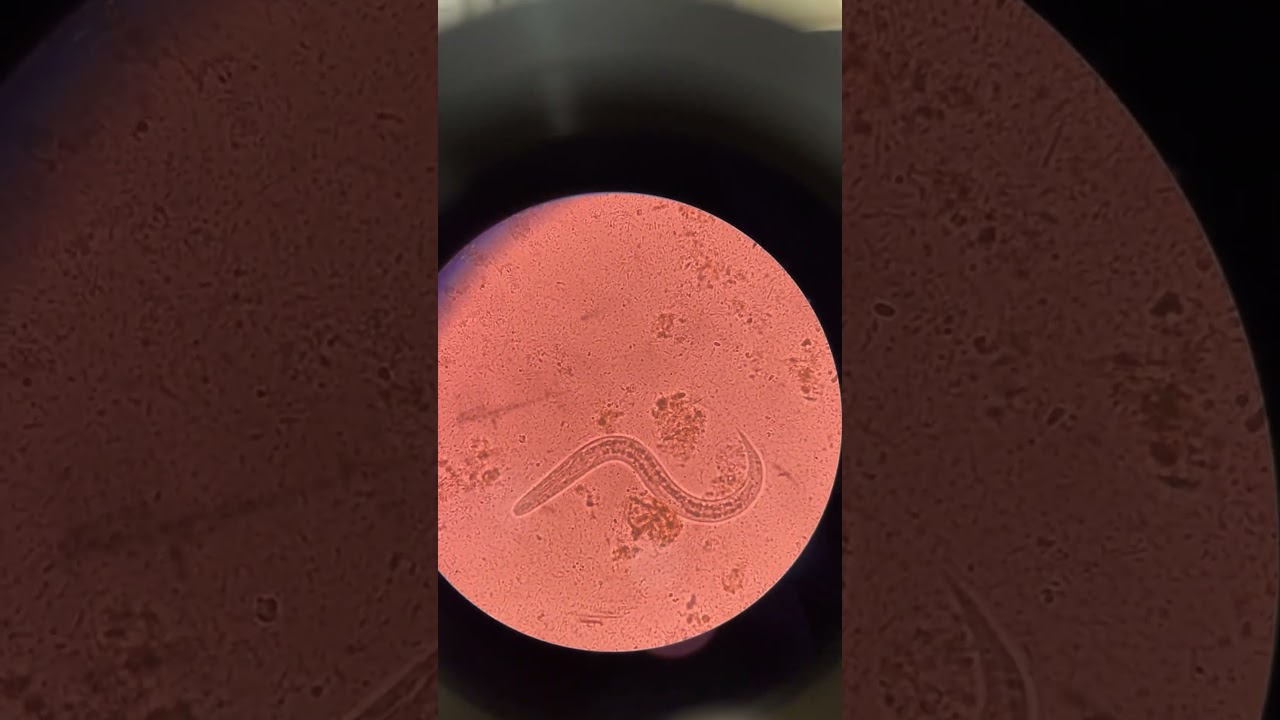 Strongyloides stercoralis under the microscope #fypシ