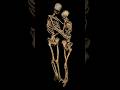 They Were Buried Hugging 1,500 Years Ago
