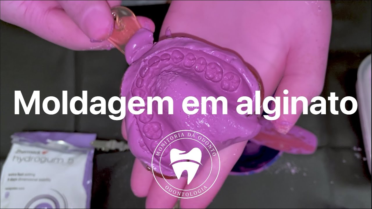 Moldagem em alginato e modelo de gesso