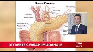 Op. Dr. Metin KARADENİZ - TGRT Haber Anahaber - Metabolik Cerrahi (Şeker Ameliyatı)