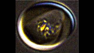 Malaria Iron Crystal
https://scitechdaily.com/the-bizarre-malaria-mystery-that-stumped-researchers-for-decades/
Microscope video of iron crystals spinning in a live malaria parasite (guitar pick shape) within a human red blood cell (larger circle).
Credit: Erica Hastings Malaria Iron Crystal