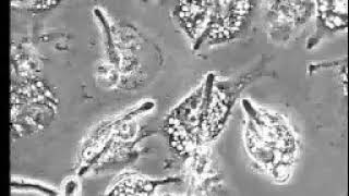 Candida producing germ tubes and killing macrophages from within.