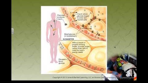 Paramedic Endocrine Emergencies Summer 2014