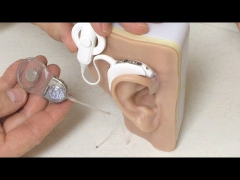 Sound Science: Hybrid Cochlear Implants