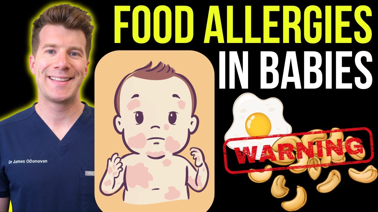 Doctor explains FOOD ALLERGIES WHEN WEANING BABIES