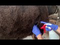 肺エコー手順　右側