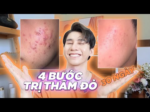 Video một SIÊU ROUTINE đặc trị THÂM ĐỎ KHÔNG HỀ ĐỂ LẠI SẸO. - youtube