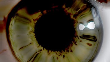 Dilation (Official Music Video)