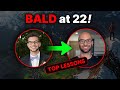 Going Bald at 22 Changed My Life - Here's What I Learned | Vlog #13