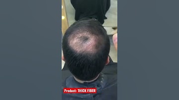 Thumbnail of Thinning Hair Concealer ! Hair Transformation