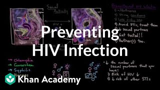 Preventing an HIV infection | Infectious diseases | NCLEX-RN | Khan Academy