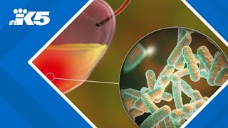 New antibiotic approved in US to treat urinary tract infections: HealthLink