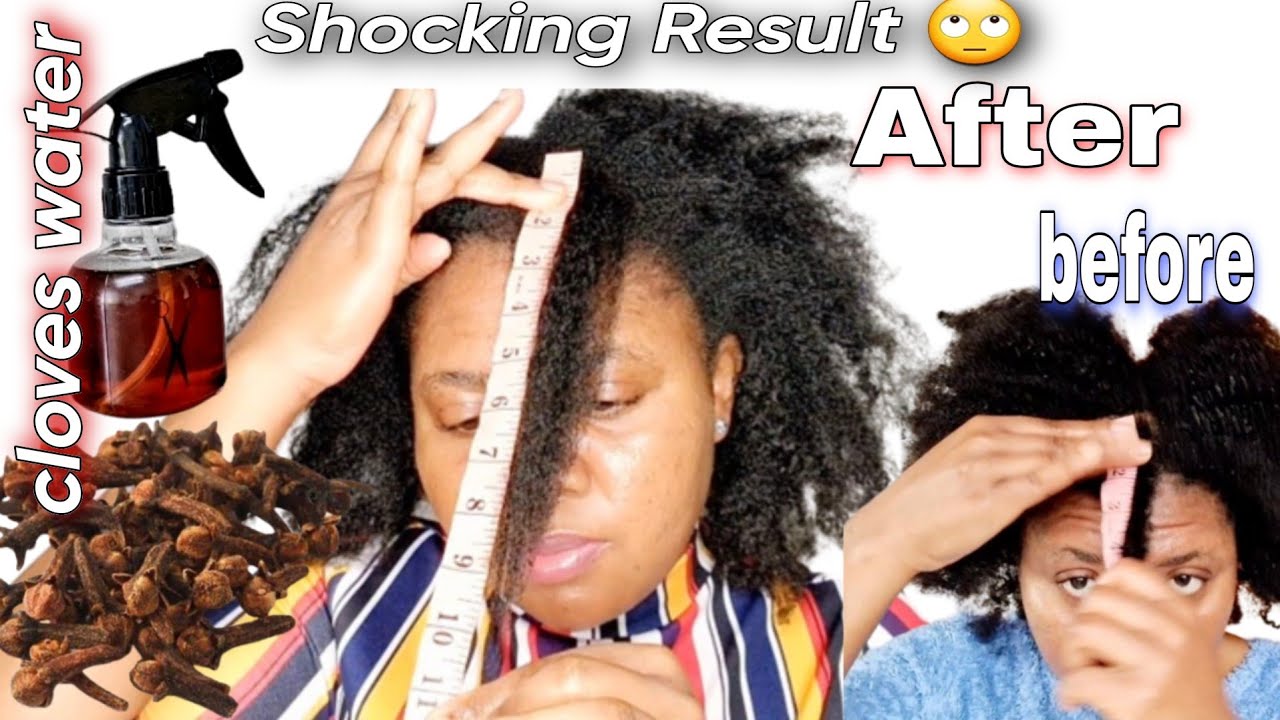 SHOCKED!!! 14 Days Cloves Hair Growth Challenge; Before and After