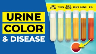 Urine Color Disease Warning! by Heart Disease Code 262,184 views 6 months ago 14 minutes, 7 seconds