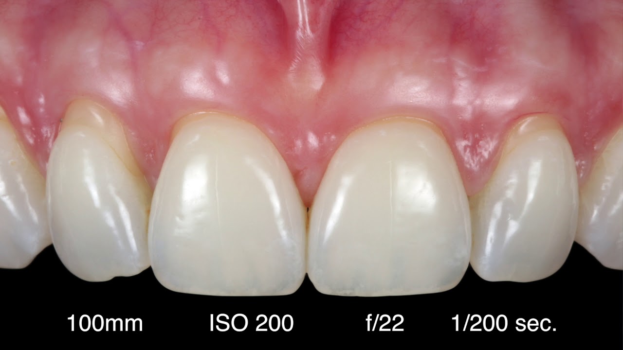 Digital Dental Photography (3 of 9) Fotografia Intraorale attrezzatura e settaggio