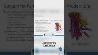 Chemo Before Surgery Explained