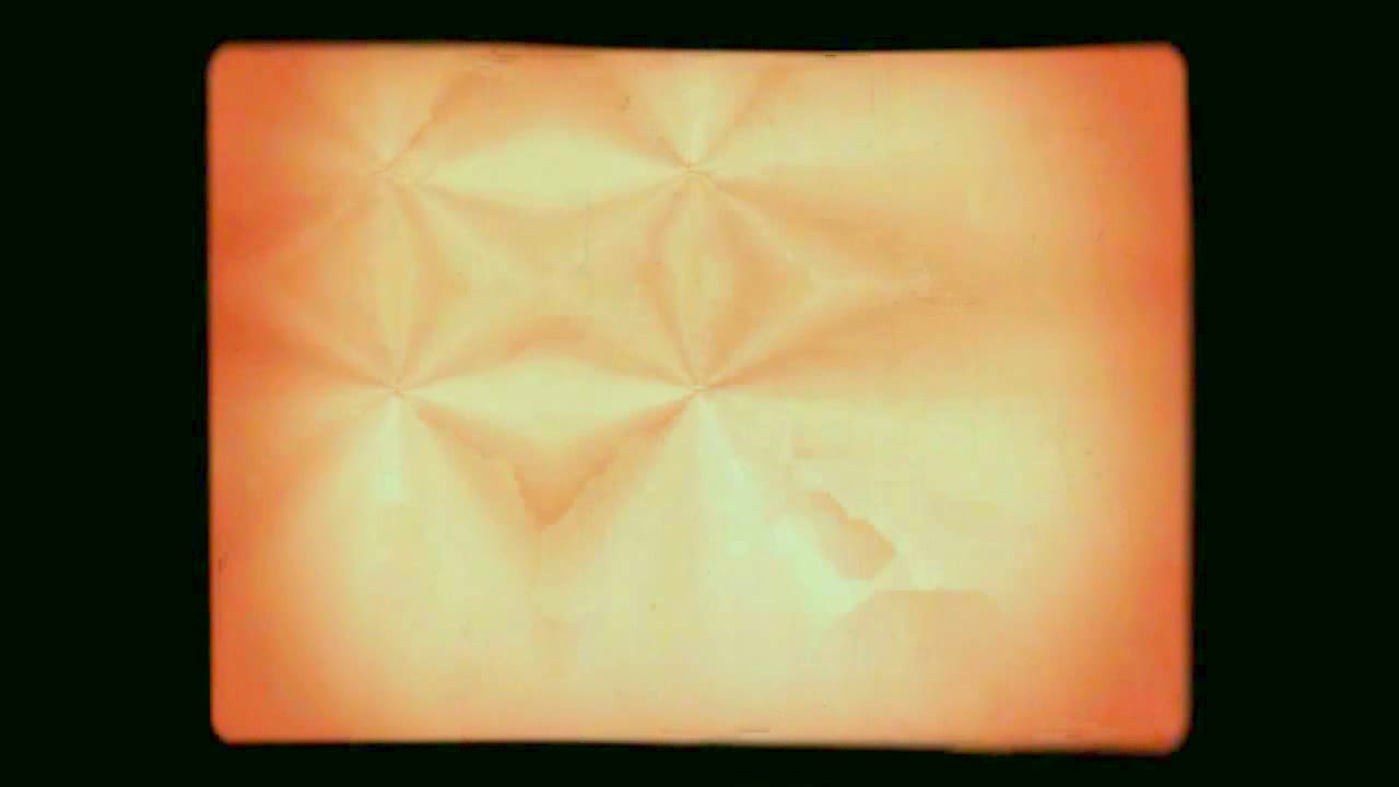 Vagus Nerve Stimulation Music-11218 - YouTube