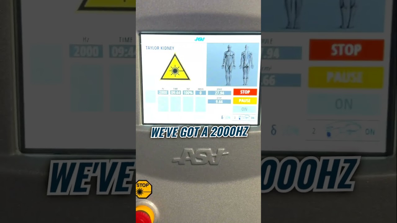 See the M7 Laser in action: advanced kidney treatments with precision and care!