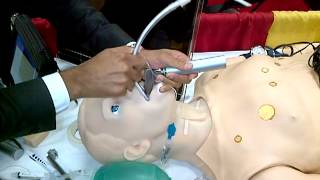 Pocket Bougie, One Person intubation technique with trigger hold