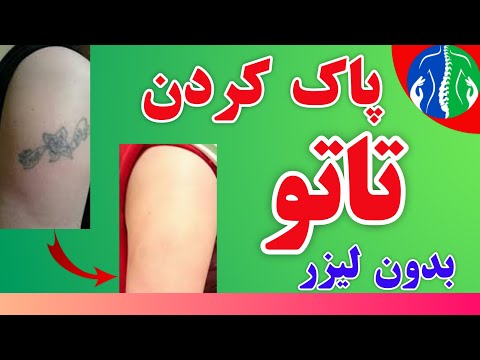 تصویری: 3 روش برای تیره کردن تاتو