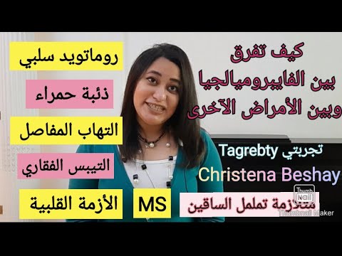 كيف اتأكد من تشخيص الفايبروميالجيا و الأمراض المتشابهة- روماتويد سلبي-ذئبة-MS -التيبس-تململ الساق