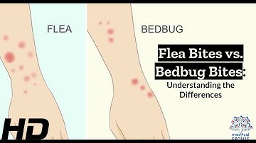 Bug Bite Showdown: Identifying Flea vs. Bedbug Bites