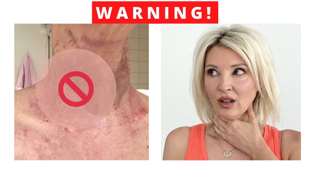 The risks of Fraxel (Fractional) Laser / Over 50 YouTube
