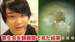 顕微鏡で寄生虫観たら想像以上に動きがエゲツなかったwww