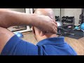 How to find and treat neck trigger points - neck pain trigger point therapy - anterior neck
