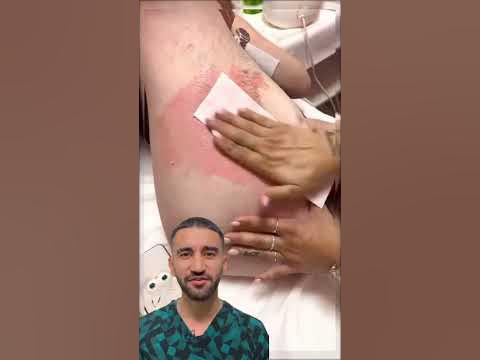 восковая эпиляция будет не больно - YouTube