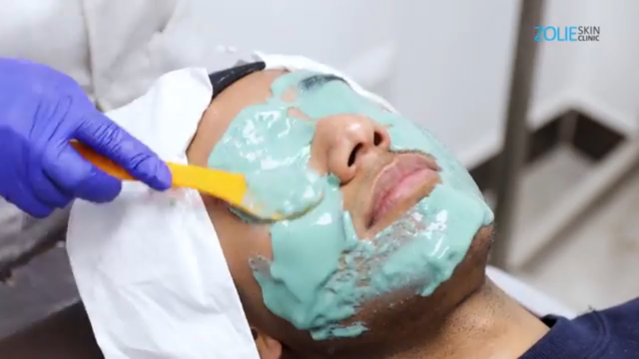 Chemical Peel and Microdermabrasion for Dull Looking Skin Men's facial Skin clinic in Delhi