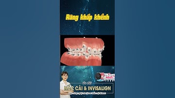 HÔ BIẾN HÀM RĂNG KHẤP KHỂNH !!!