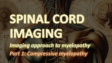 Imaging of the Spinal Cord (1): Intro & compressive myelopathy