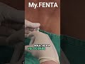 PEYRONIE : MISTURINHA ANTES DA RAQUI